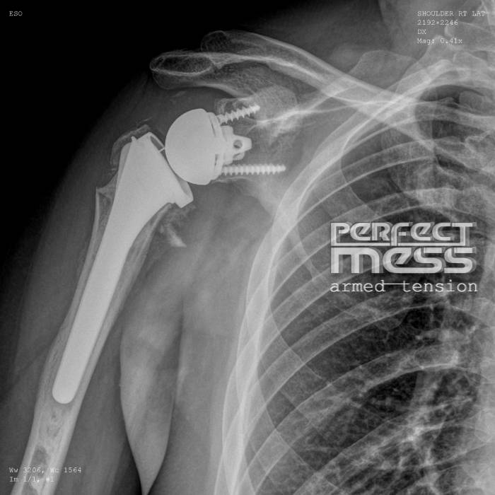 Perfect Mess-Armed Tension